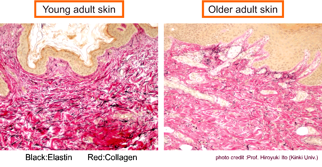 肌とエラスチンの関係