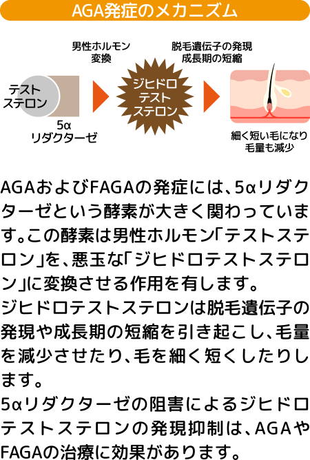 AGA発症のメカニズムル