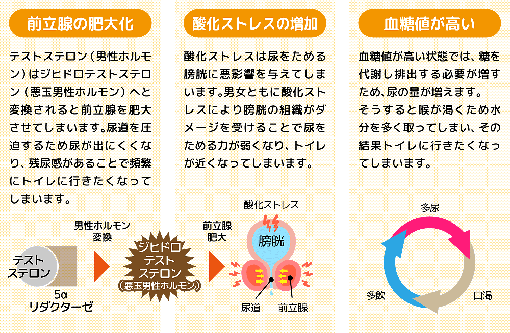 頻尿の原因：前立腺肥大化、酸化ストレス・高血糖値